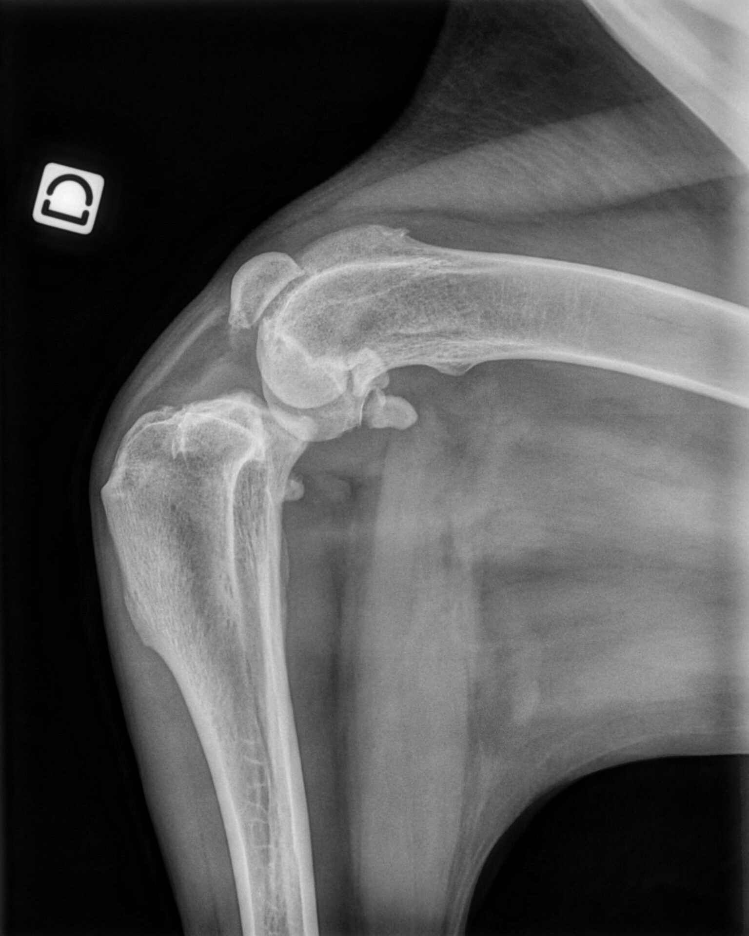 Does Pet Insurance Cover ACL Surgery?